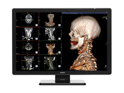 Precision Imaging for Diagnostic Excellence