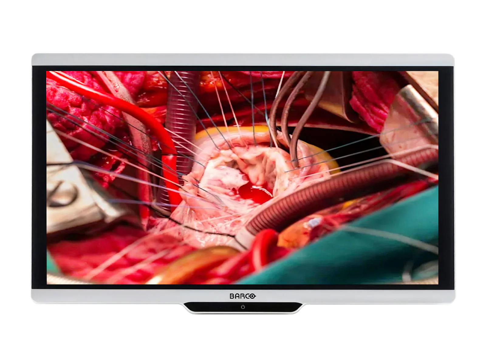 Barco MDSC-8427 12G OLY 27" 8MP 4K UHD Surgical Medical Display Monitor (K9352153)