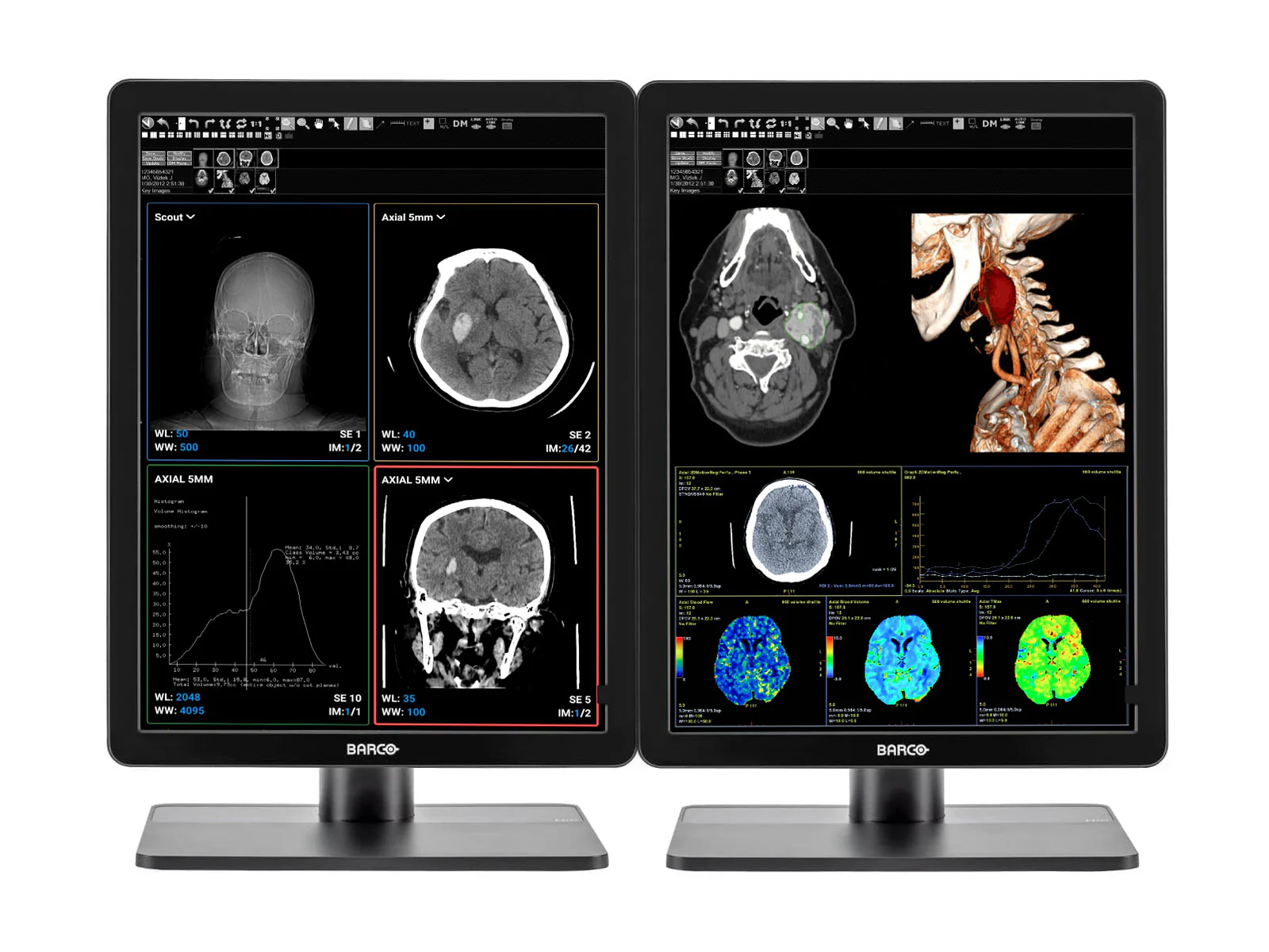 Pair (x2) Barco Nio MDNC-3421 3MP with 21" Color General Radiology Monitors with MXRT-6700