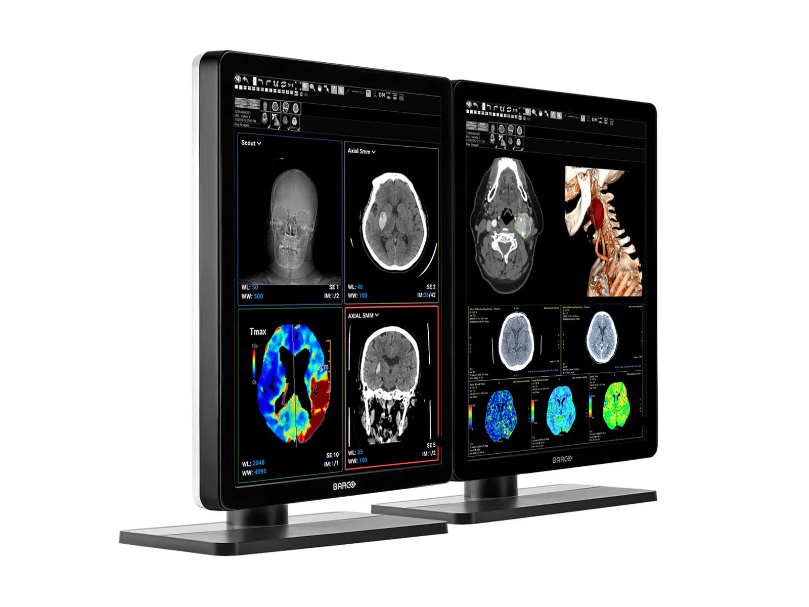 Pair (x2) Barco Nio MDNC-3421 3MP with 21" Color General Radiology Monitors with MXRT-6700 - Image 2