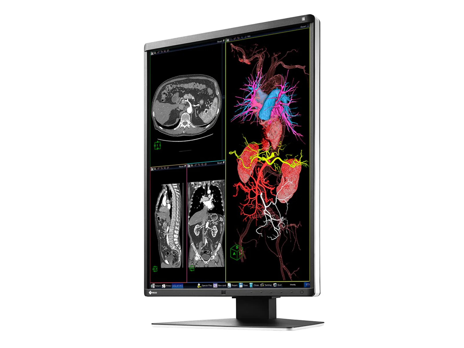 Eizo RadiForce RX360 3MP 21" Color General Radiology PACS Display Monitor (RX360) - Image 5