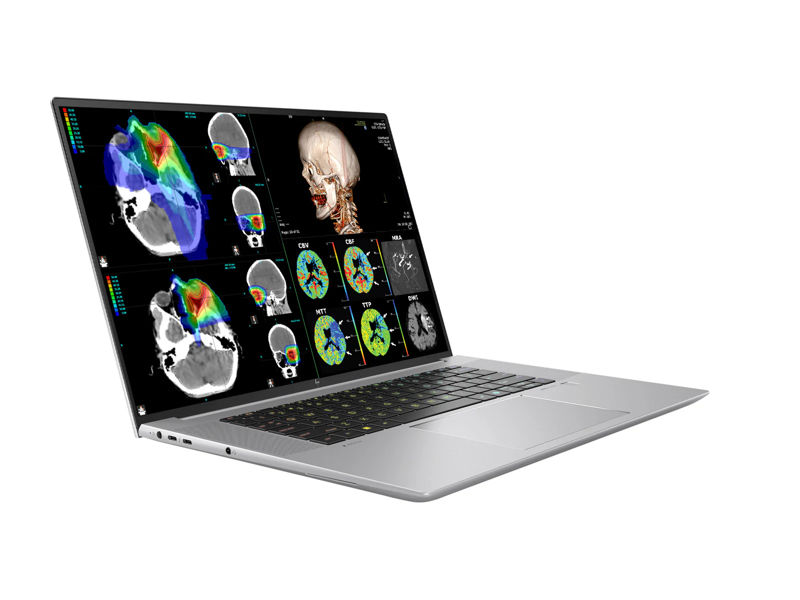 HP ZBook Studio 16 G11 Mobile Radiology Workstation | 16" WUXGA DICOM Calibrated | Intel Core Ultra 7 155H @ 4.8GHz | 16-core | 16GB DDR5 | 512GB NVMe SSD | RTX 1000 Ada 6GB | WiFi 7 - Image 2
