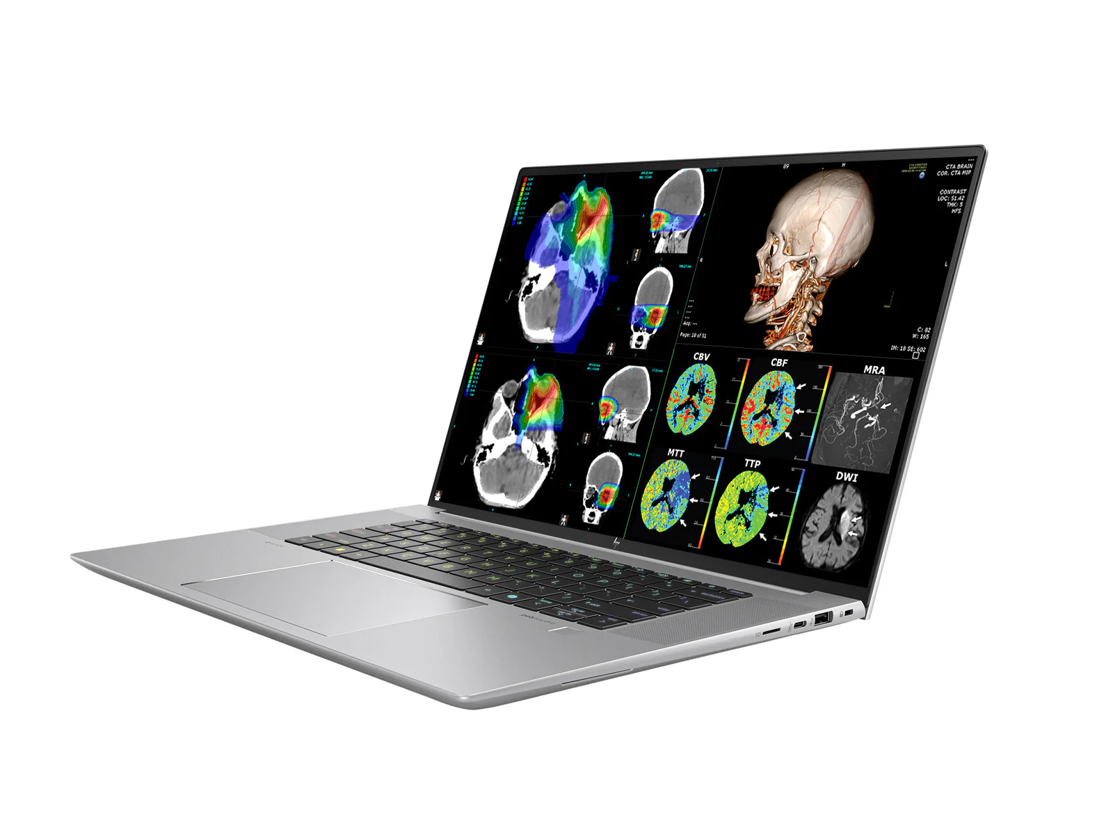 HP ZBook Studio 16 G11 Mobile Radiology Workstation | 16" WUXGA DICOM Calibrated | Intel Core Ultra 7 155H @ 4.8GHz | 16-core | 16GB DDR5 | 512GB NVMe SSD | RTX 1000 Ada 6GB | WiFi 7 - Image 3