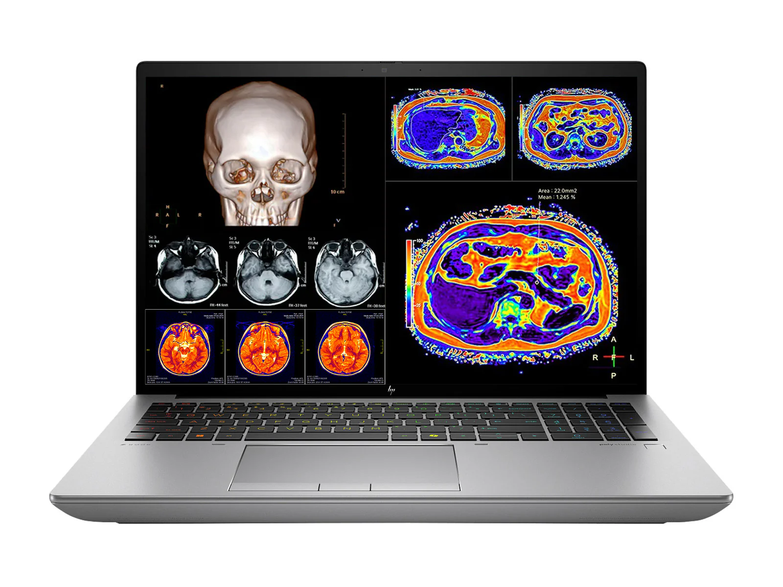 HP ZBook Fury 16 G11 Mobile Radiology Workstation | 16" WUXGA DICOM Calibrated | Core i7-13850HX @ 5.30GHz | 20-Core | 32GB ECC DDR5 | 512GB NVMe SSD | RTX 3500 Ada 12GB | WiFi 7