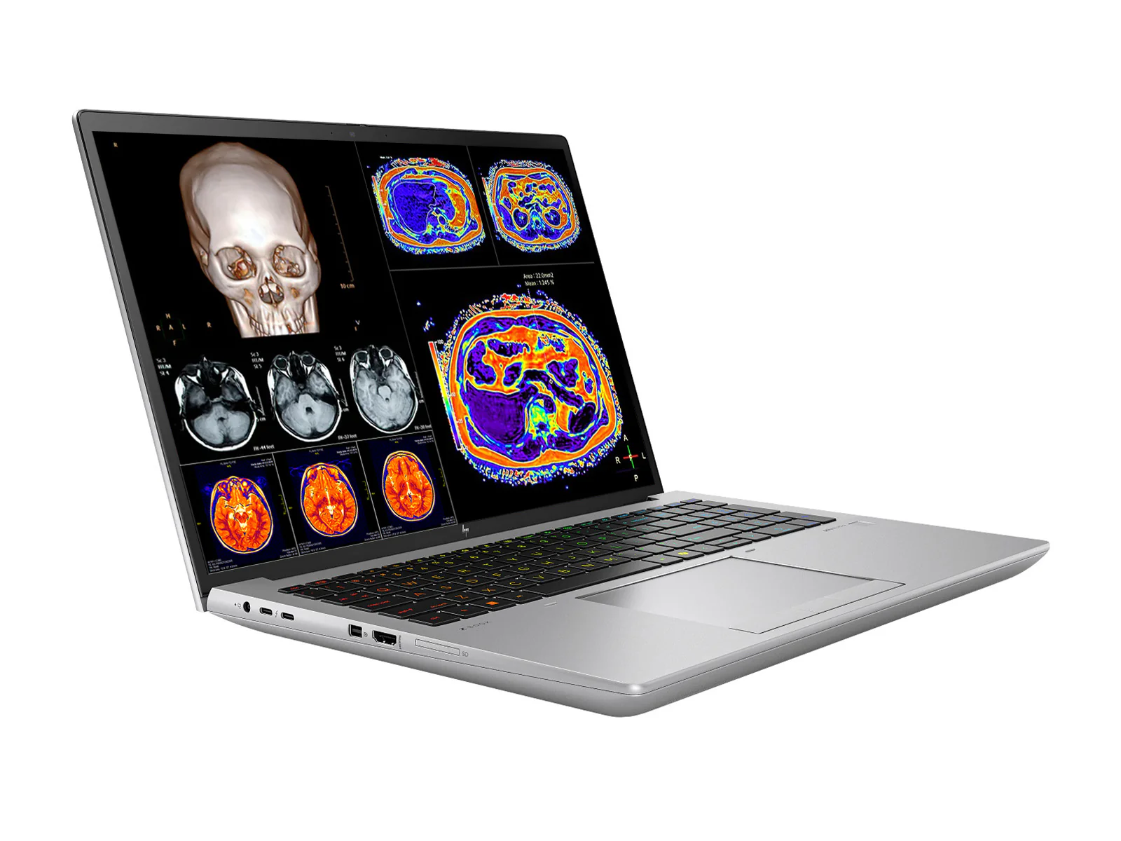 HP ZBook Fury 16 G11 Mobile Radiology Workstation | 16" WUXGA DICOM Calibrated | Core i7-13850HX @ 5.30GHz | 20-Core | 32GB ECC DDR5 | 512GB NVMe SSD | RTX 3500 Ada 12GB | WiFi 7 - Image 2