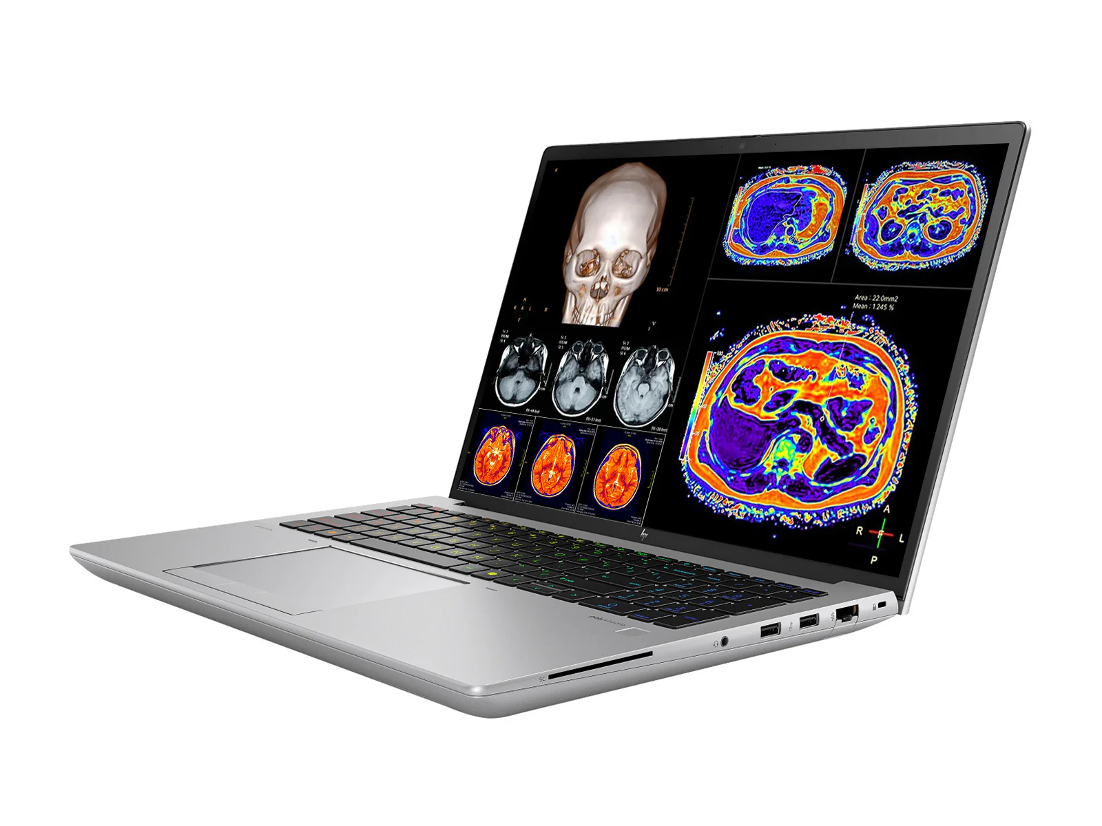 HP ZBook Fury 16 G11 Mobile Radiology Workstation | 16" WUXGA DICOM Calibrated | Core i7-13850HX @ 5.30GHz | 20-Core | 32GB ECC DDR5 | 512GB NVMe SSD | RTX 3500 Ada 12GB | WiFi 7 - Image 3