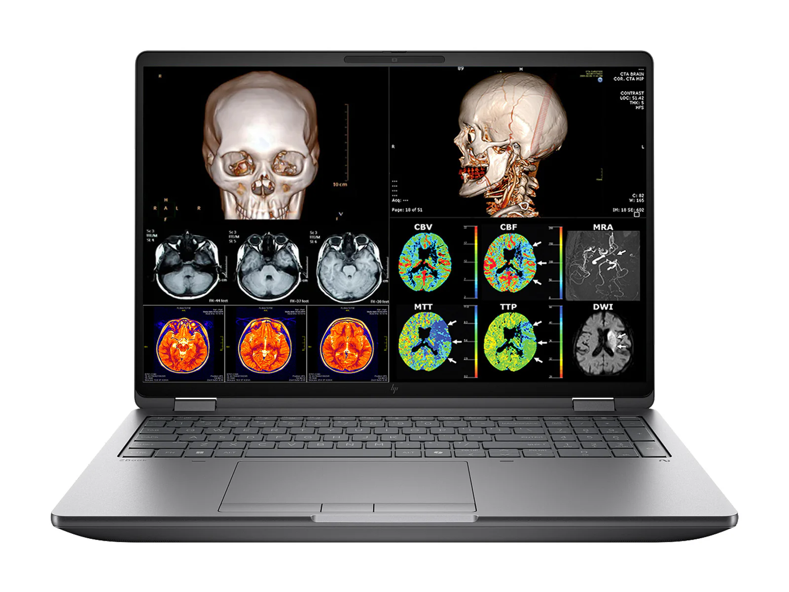 HP ZBook Fury G1i 16 Mobile Workstation | 16" DICOM Calibrated 9MP 4K+ UHD WQUXGA (3840 x 2400) Display | Intel Core Ultra 7 255HX @ 5.2GHz MT | 20-Core | 32GB DDR5 | 512GB NVMe SSD | RTX PRO 1000 Blackwell 8GB | WiFi 7 | PerfectLUM License - Image 2