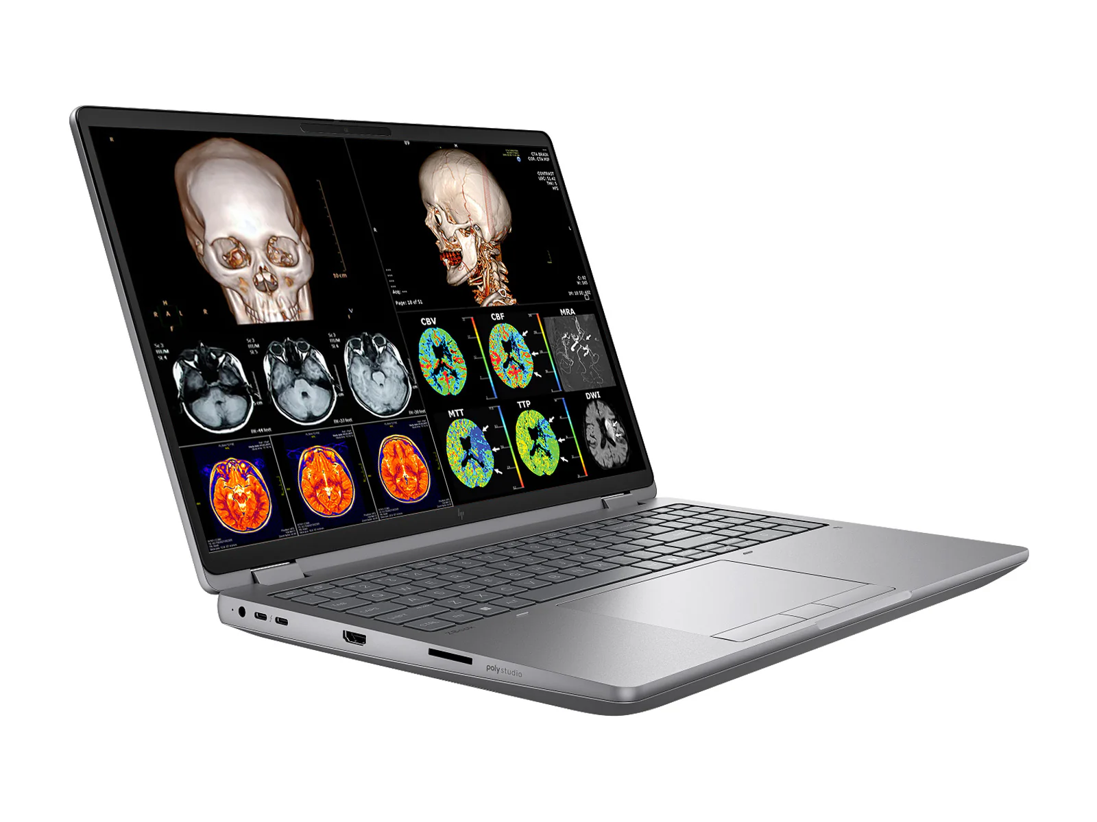 HP ZBook Fury G1i 16 Mobile Workstation | 16" DICOM Calibrated 9MP 4K+ UHD WQUXGA (3840 x 2400) Display | Intel Core Ultra 7 255HX @ 5.2GHz MT | 20-Core | 32GB DDR5 | 512GB NVMe SSD | RTX PRO 1000 Blackwell 8GB | WiFi 7 | PerfectLUM License - Image 3