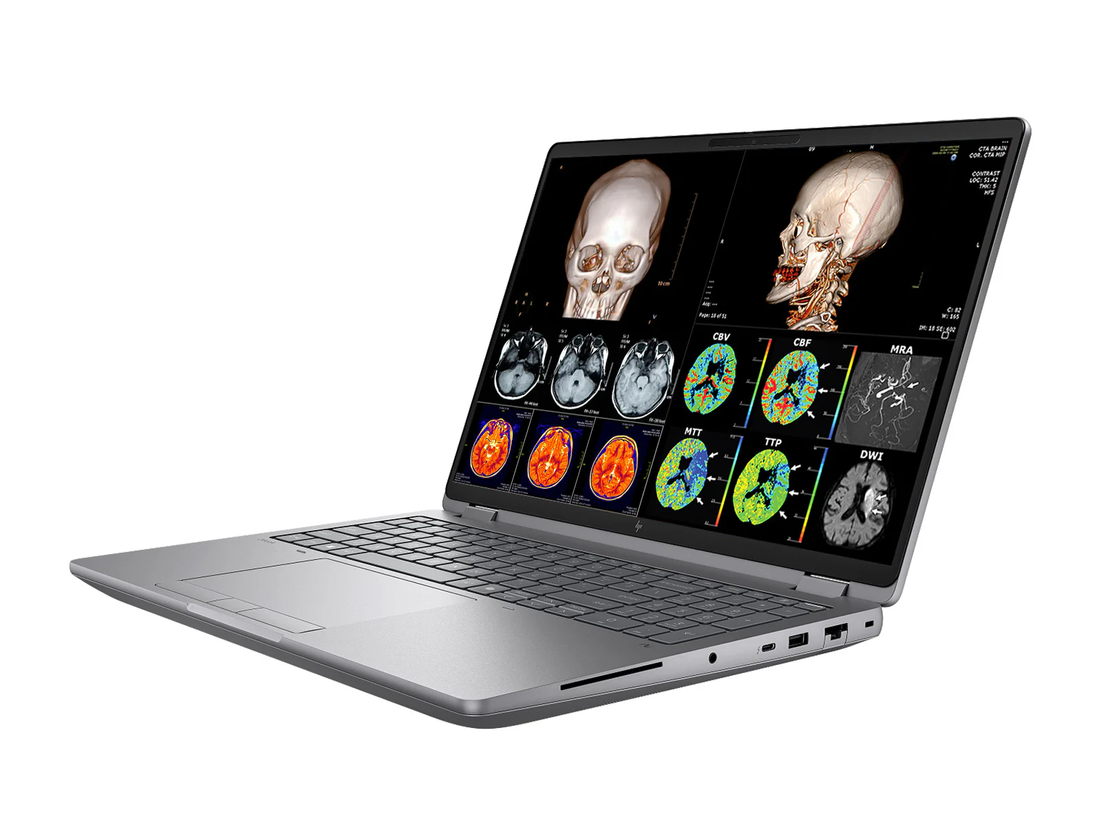 HP ZBook Fury G1i 16 Mobile Workstation | 16" DICOM Calibrated 9MP 4K+ UHD WQUXGA (3840 x 2400) Display | Intel Core Ultra 7 255HX @ 5.2GHz MT | 20-Core | 32GB DDR5 | 512GB NVMe SSD | RTX PRO 1000 Blackwell 8GB | WiFi 7 | PerfectLUM License - Image 4