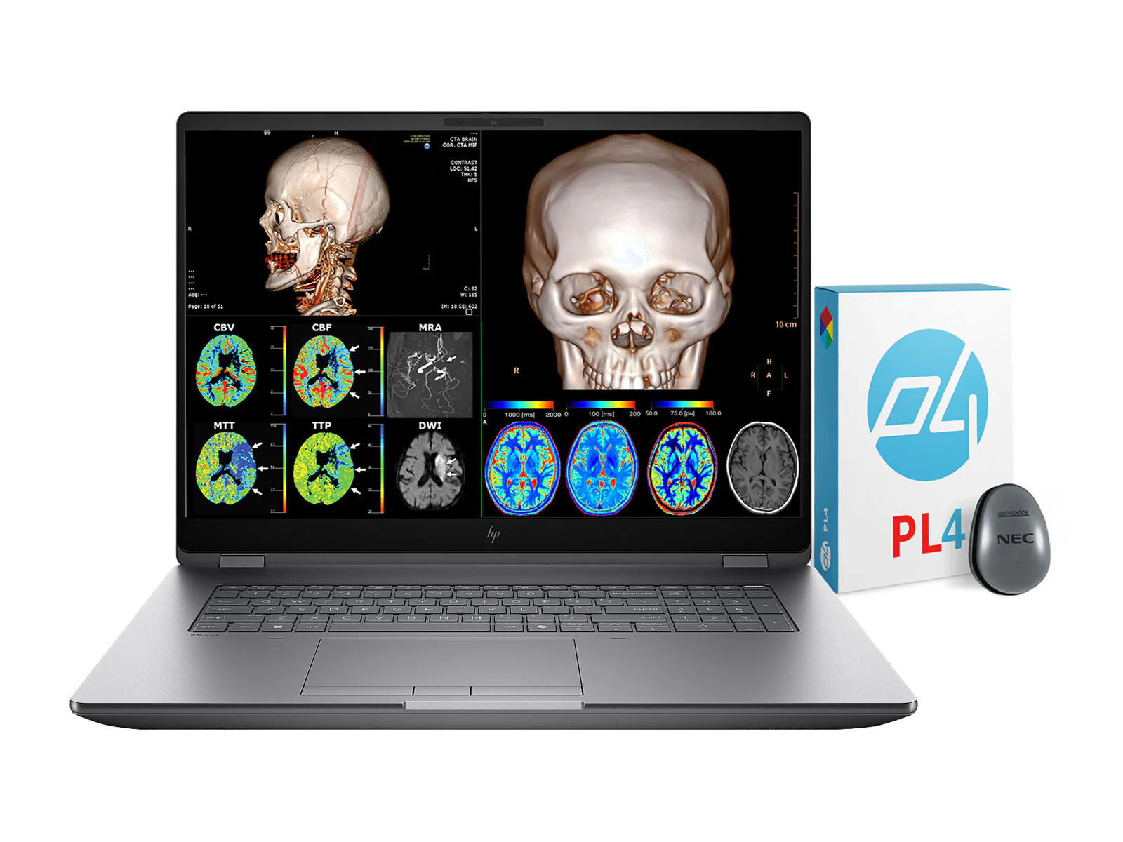 HP ZBook Fury G1i 18 Mobile Workstation | 18" DICOM Calibrated WQXGA QHD+ 4MP (2560 x 1600) Display | Intel Core Ultra 7 255HX @ 5.2GHz MT | 20-Core | 32GB DDR5 | 512GB NVMe SSD | RTX PRO 1000 Blackwell 8GB | WiFi 7 | PerfectLUM License