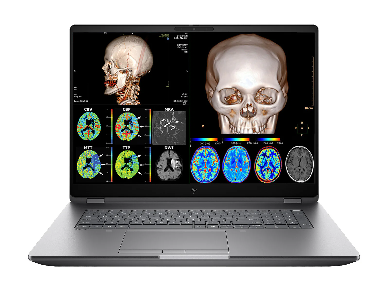 HP ZBook Fury G1i 18 Mobile Workstation | 18" DICOM Calibrated WQXGA QHD+ 4MP (2560 x 1600) Display | Intel Core Ultra 7 255HX @ 5.2GHz MT | 20-Core | 32GB DDR5 | 512GB NVMe SSD | RTX PRO 1000 Blackwell 8GB | WiFi 7 | PerfectLUM License - Image 2