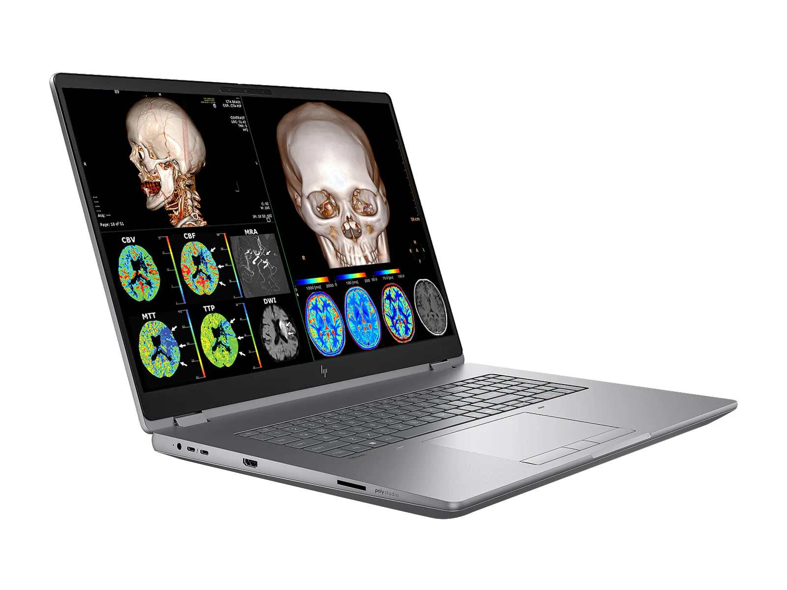 HP ZBook Fury G1i 18 Mobile Workstation | 18" DICOM Calibrated WQXGA QHD+ 4MP (2560 x 1600) Display | Intel Core Ultra 7 255HX @ 5.2GHz MT | 20-Core | 32GB DDR5 | 512GB NVMe SSD | RTX PRO 1000 Blackwell 8GB | WiFi 7 | PerfectLUM License - Image 3