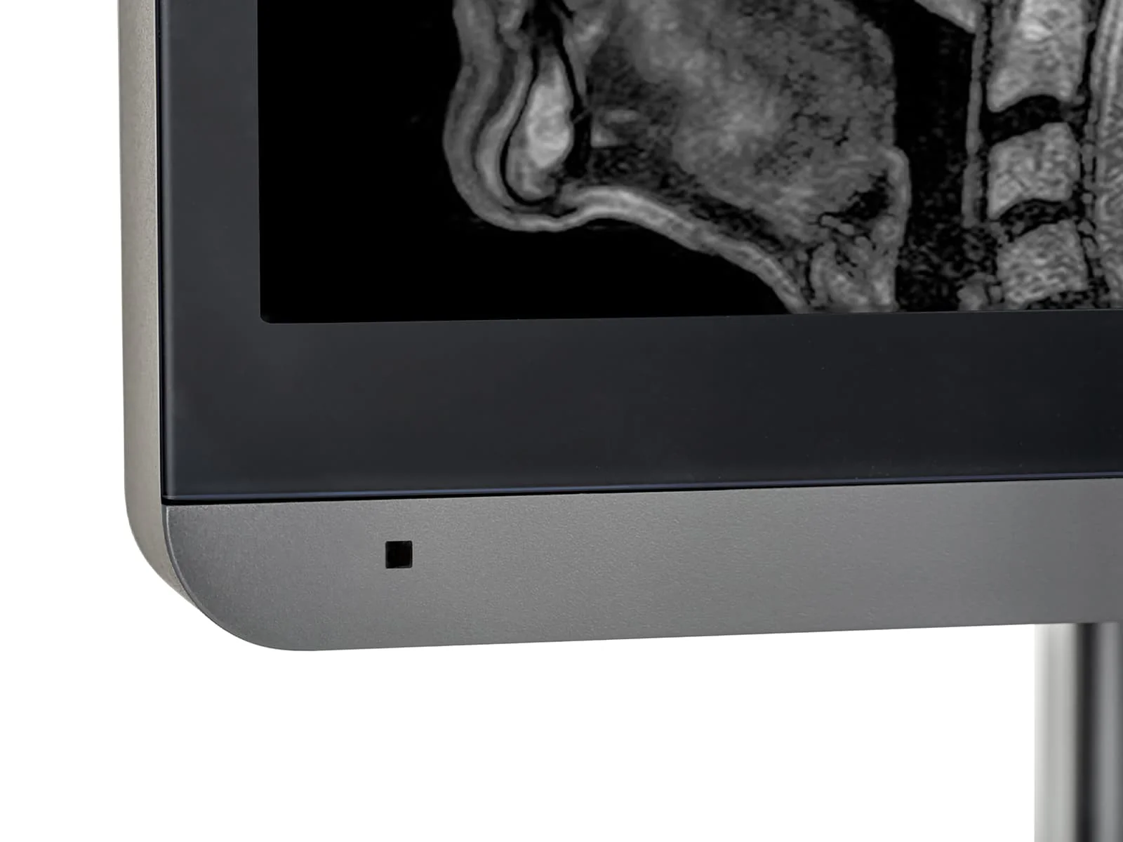 JVC Totoku MS-S300 3MP 21" Grayscale General Radiology Diagnostic Display Monitor (MS-S300) - Image 9